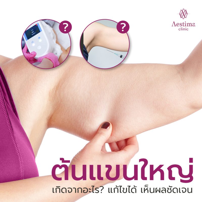 ต้นแขนใหญ่ 01_0
