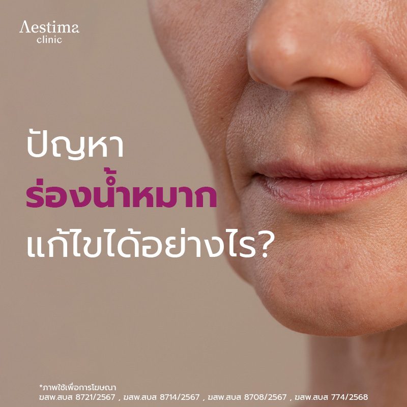 ร่องน้ำหมาก - 01_1