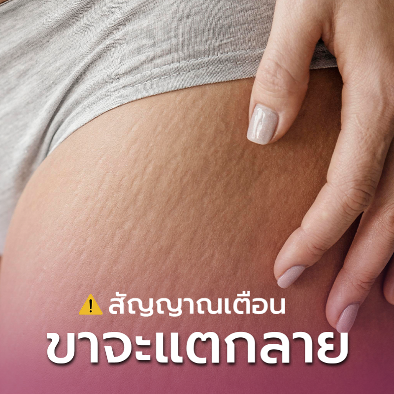 สัญญาณเตือน-ขาจะแตกลาย_0