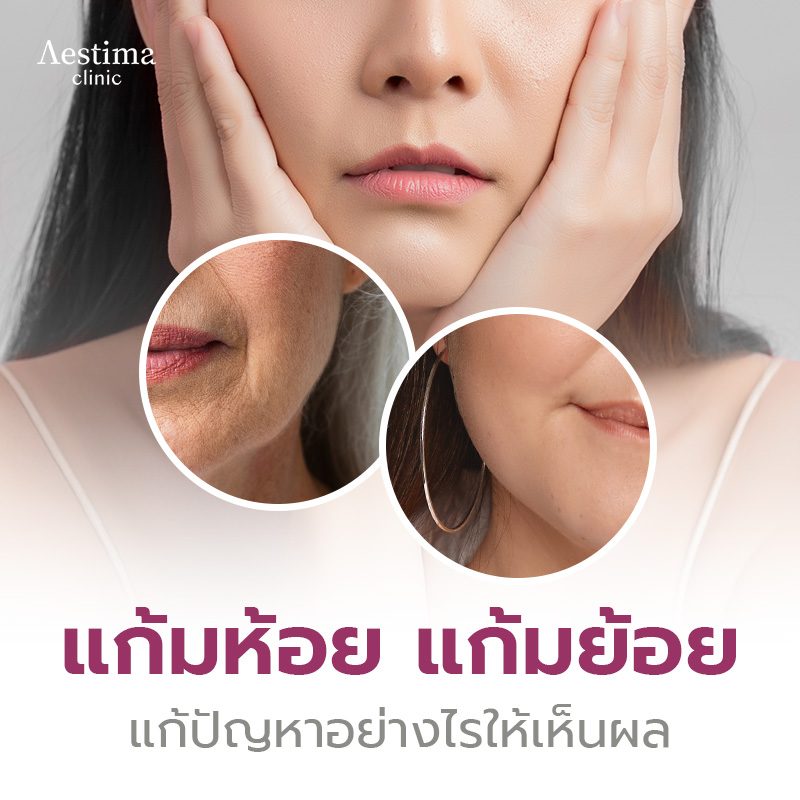 แก้มห้อย แก้มย้อย - 01_0